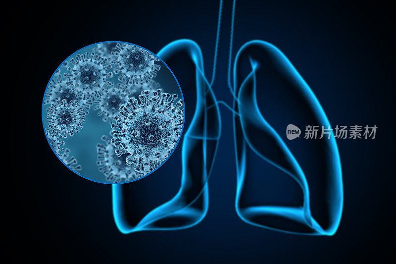 冠状病毒对肺部