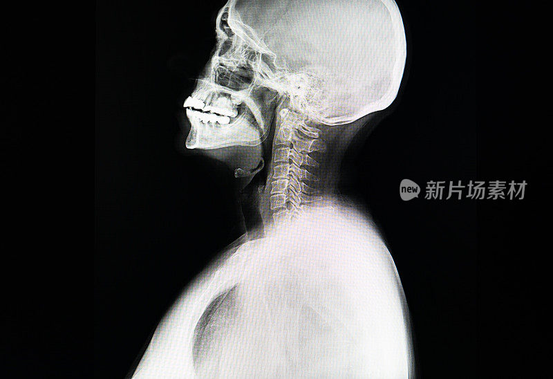 大脑核磁共振扫描。扫描大脑磁共振图像。诊断医疗工具