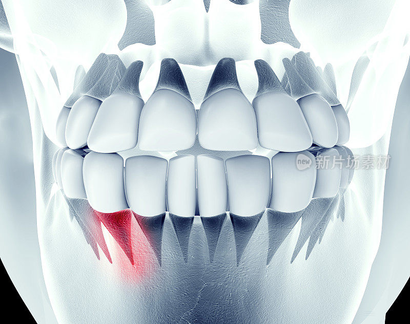 带有牙齿的颌的x光图像