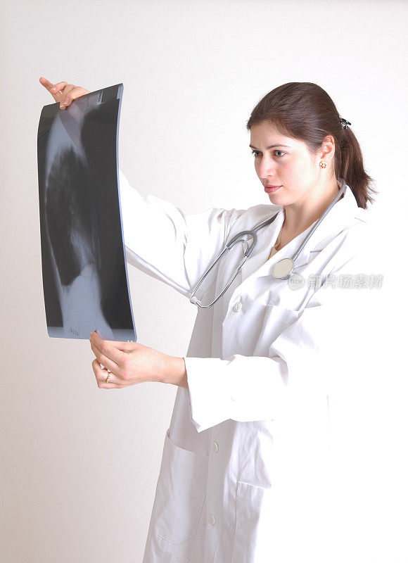 女医生在看x光片