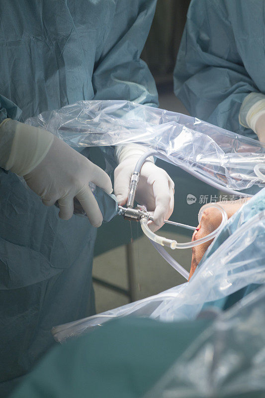 膝关节锁眼手术医院关节镜手术急诊室手术室的医疗程序