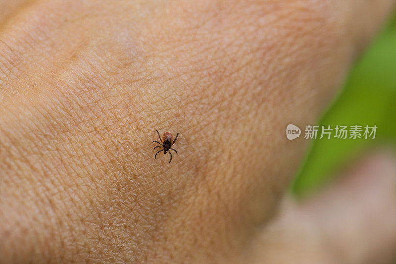 人手上的蜱虫特写