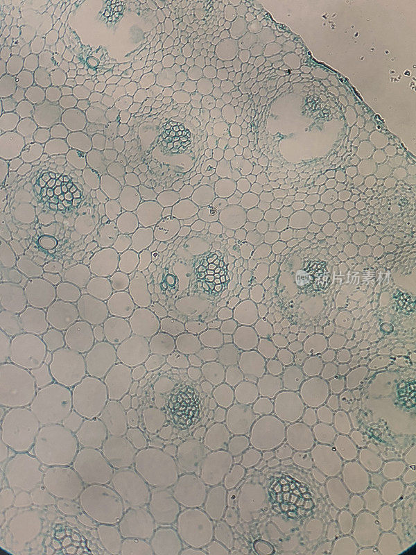 单子叶植物茎的显微镜观察图
