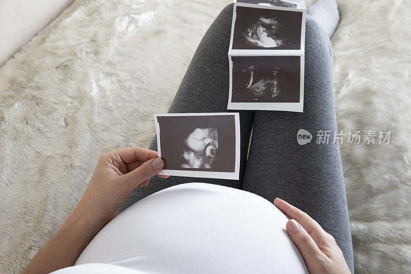 孕妇看她的超声波检查的女婴