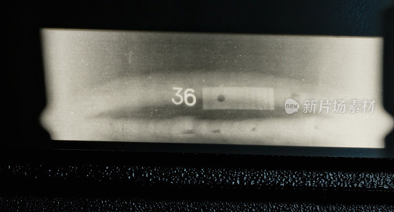 管道焊缝的x光照片
