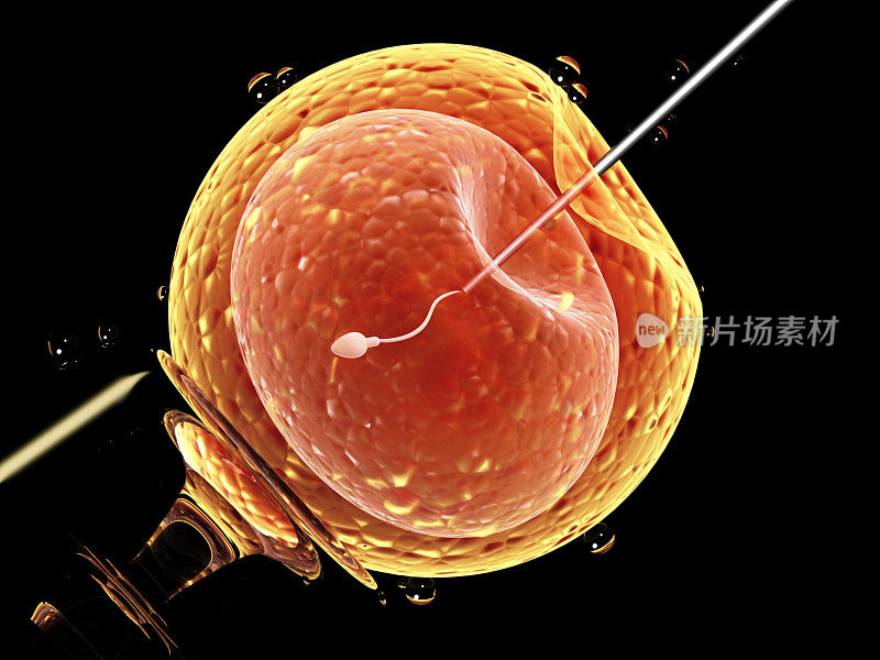 人工授精。针刺细胞膜