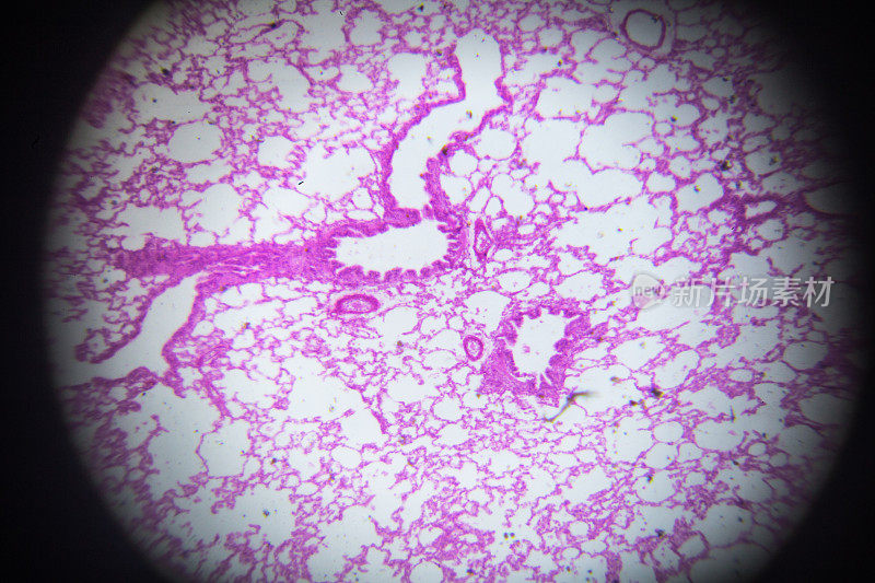 显微镜下兔肺横切面