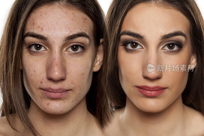 化妆前后皮肤问题