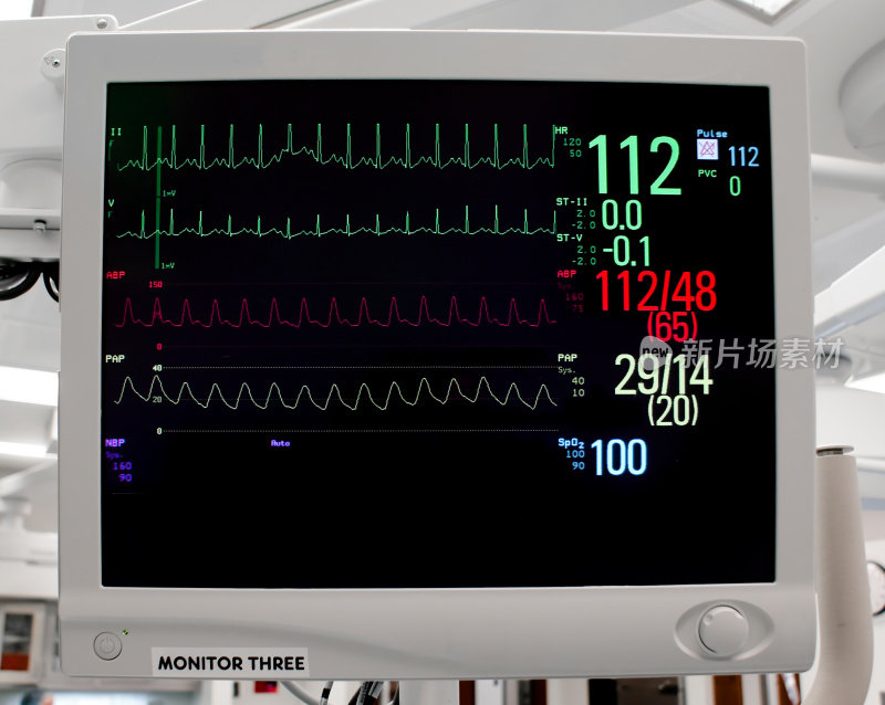 有生命体征的心脏监护仪:心电图，脉氧仪，血压