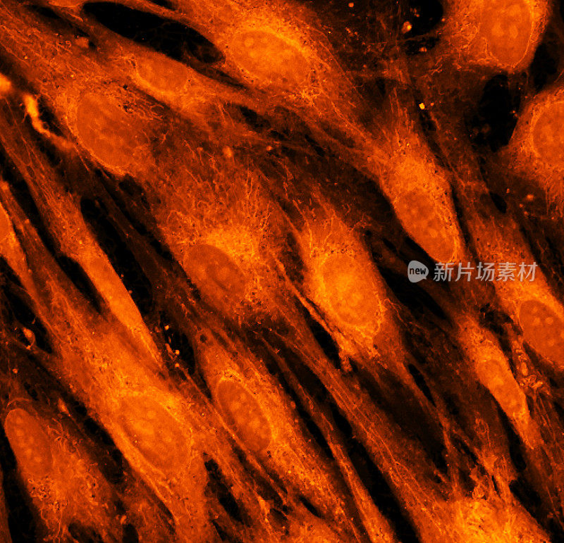成纤维细胞(皮肤细胞)用荧光染料标记