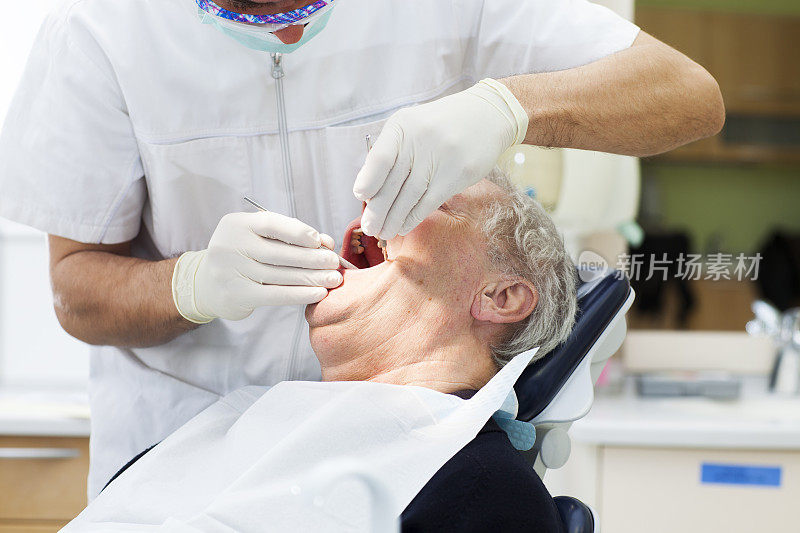 牙科医生的老病人…牙科医生正在给病人拔牙