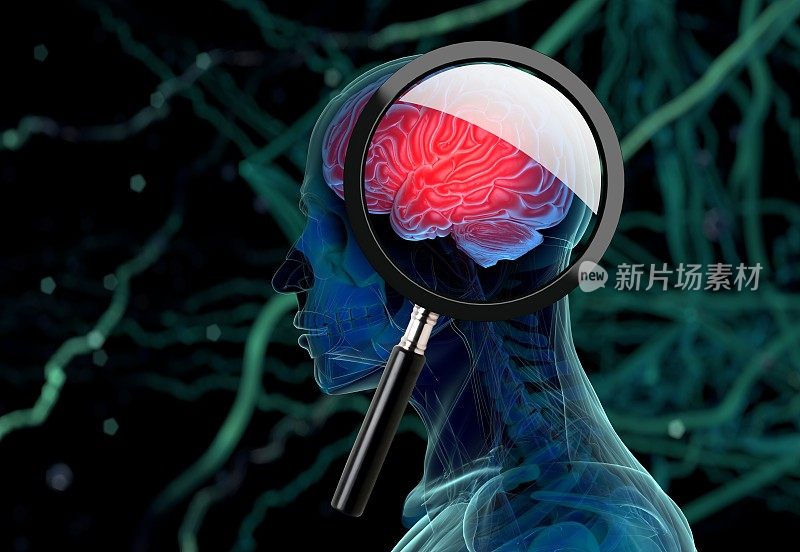 3D医学背景与放大镜检查大脑描绘老年痴呆症的研究。三维演示