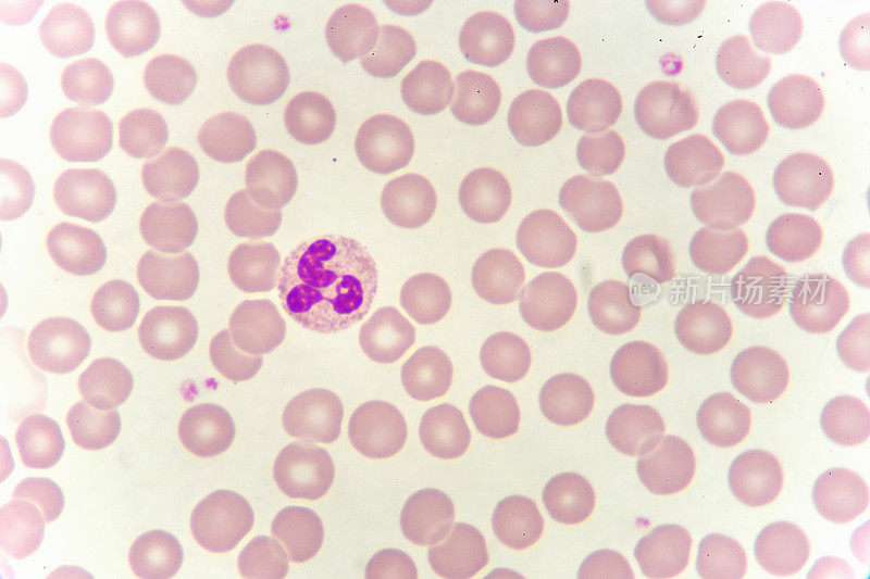 血液涂片中的中性粒细胞