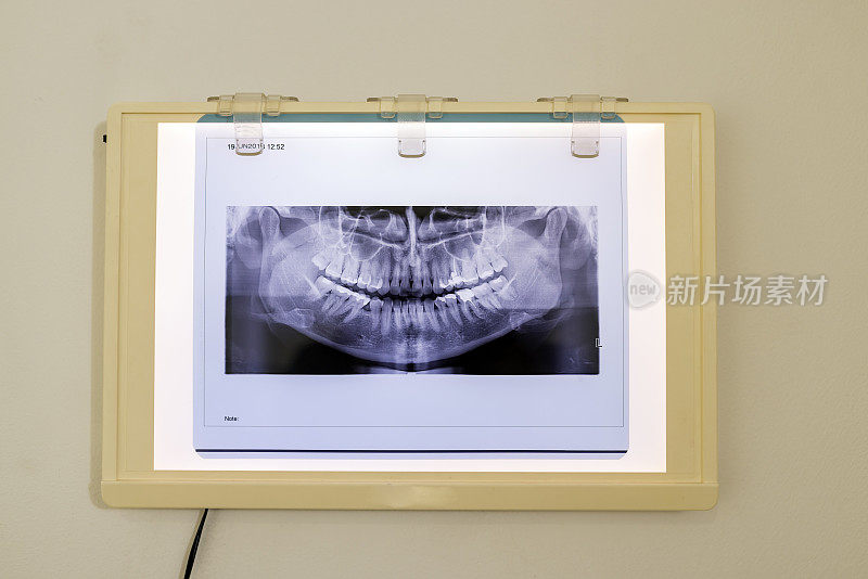 牙科诊所的x光影像