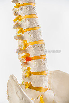 椎骨和光盘。神经退行性疾病。
