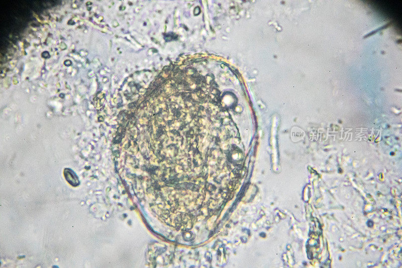 日本血吸虫虫卵光镜下观察