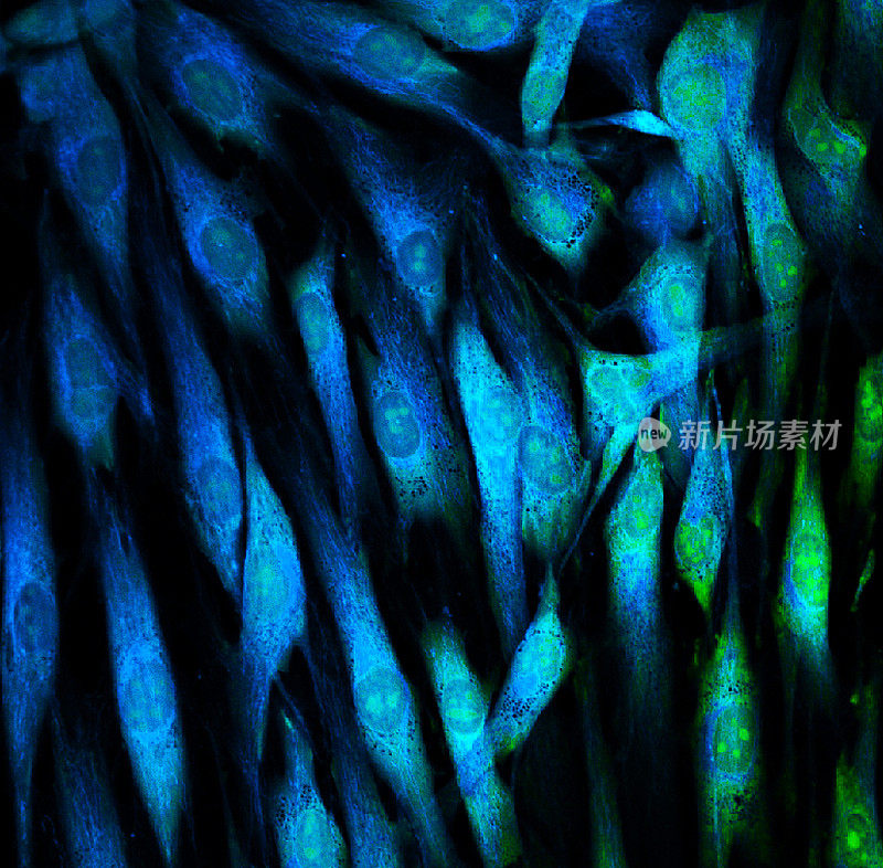 显微镜下的成纤维细胞
