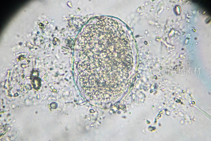 日本血吸虫虫卵光镜下观察