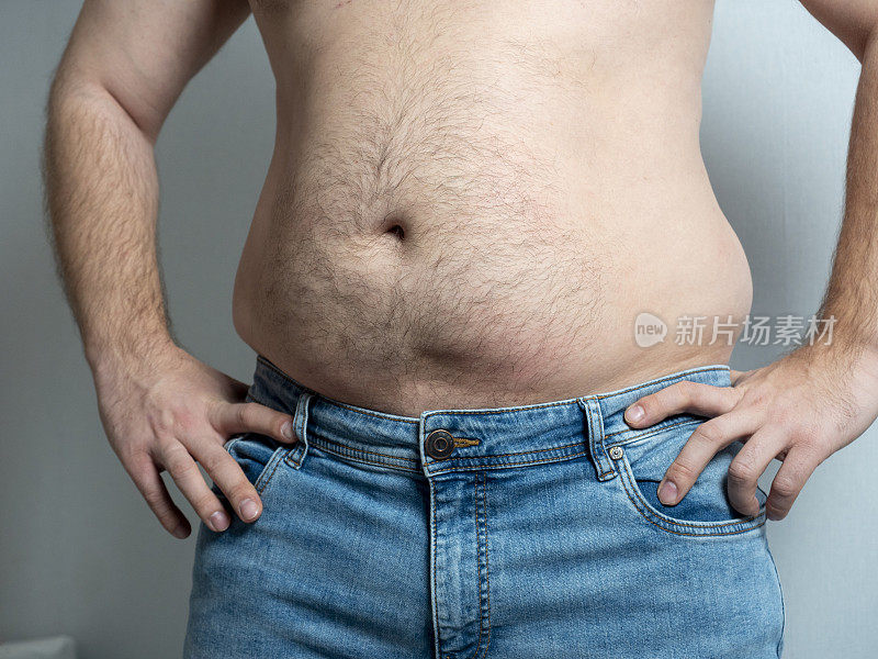 一个穿着牛仔裤的胖男人裸露的腹部。超重问题的概念