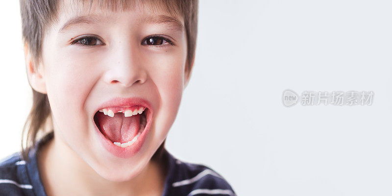微笑的孩子露出一排牙齿上的洞。刚才掉了一颗门牙。牙科医生的牙床近照。副本的空间。