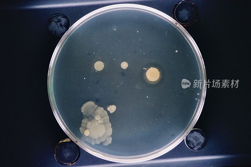 体外细菌培养