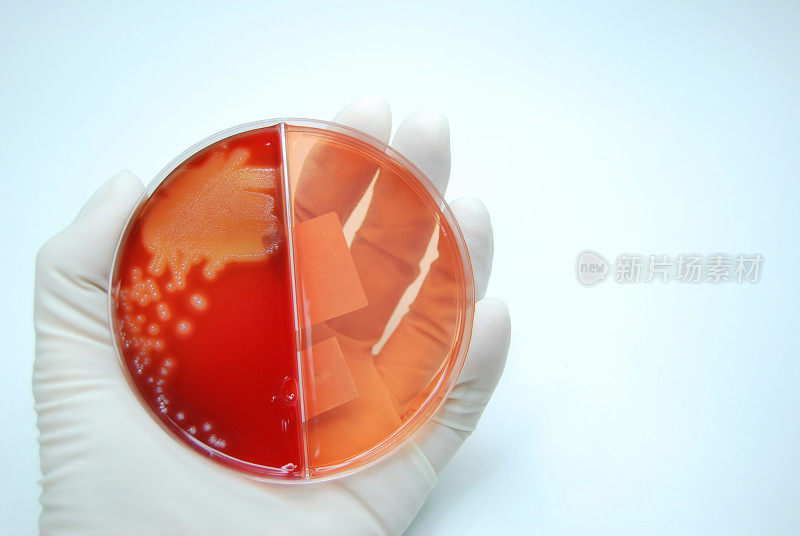 微生物,细菌培养