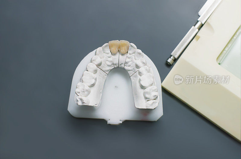 石膏牙科模型与陶瓷牙齿
