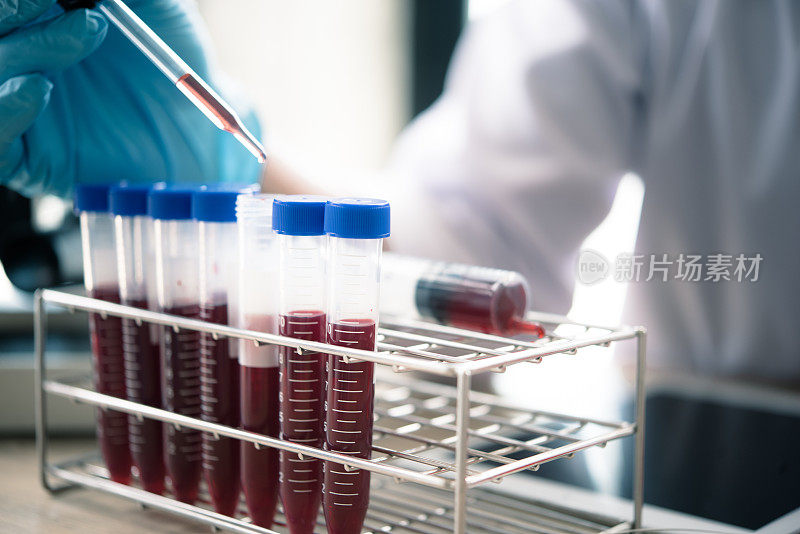 医务人员在临床实验室为分析、医疗、制药和科学研究和开发概念提供血液。