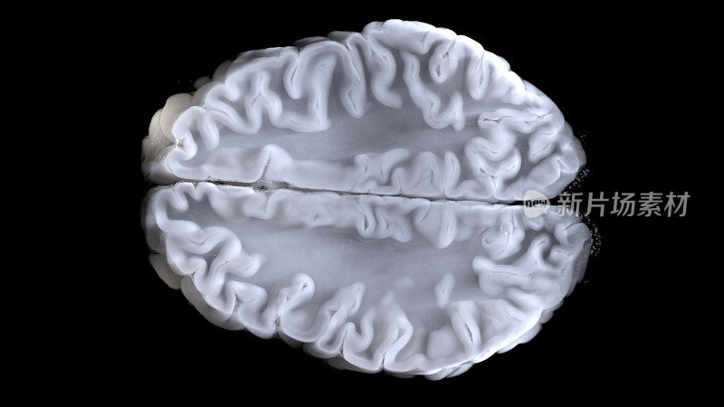 利用MTR和断层扫描技术，对人类大脑进行数字研究的三维可视化。大脑核磁共振成像(MRI)是诊断疾病的先进方法之一，被用于研究人体大部分器官。