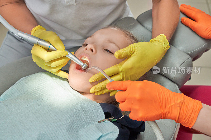 小女孩在牙科诊所治疗牙齿。