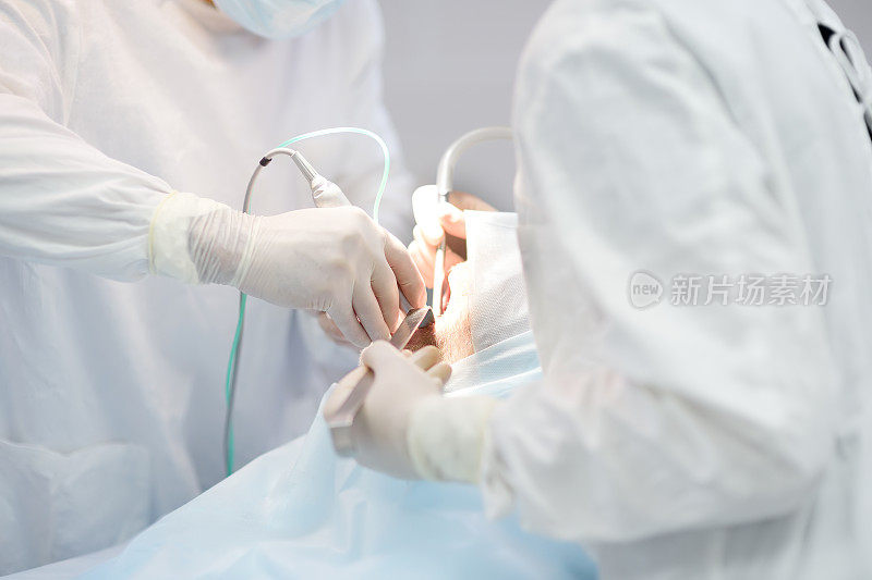 牙科手术中的外科医生和护士。在手术室麻醉病人。在诊所内安装植牙装置。
