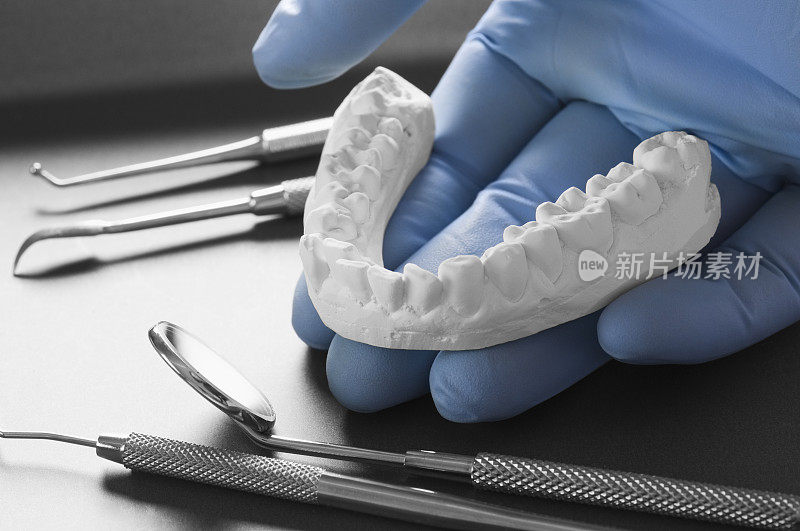 牙医拿着病人的下牙龈模型的牙医