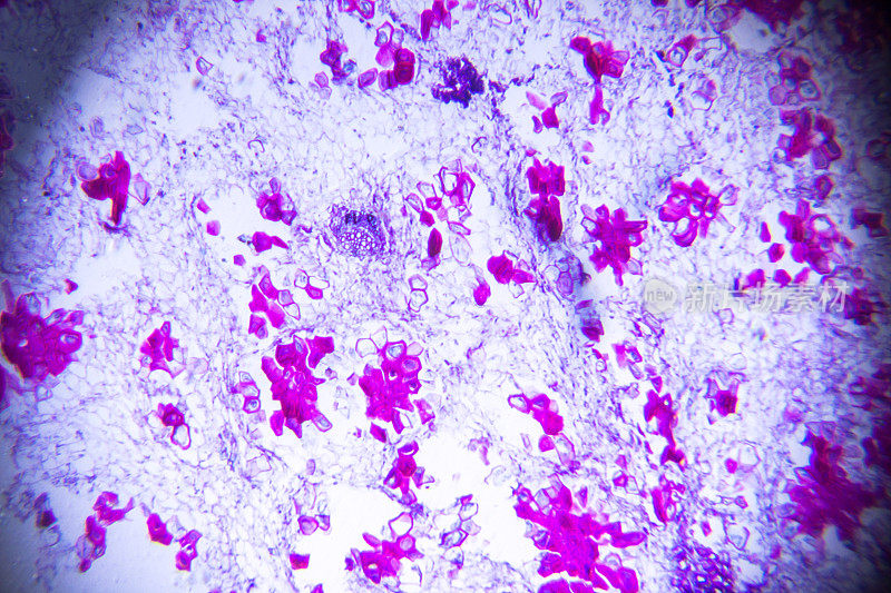 显微镜下的石梨细胞