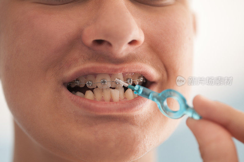 戴牙套的少年注重牙齿卫生