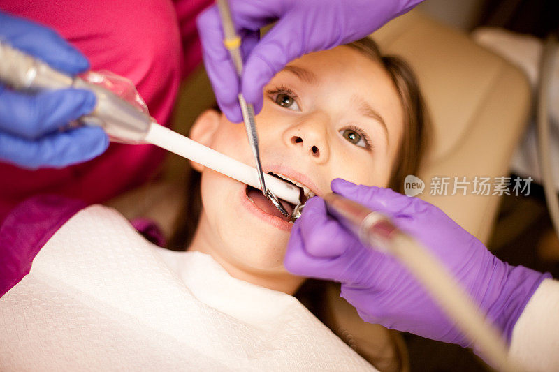 年轻女孩在牙科诊所牙科医生填补龋齿