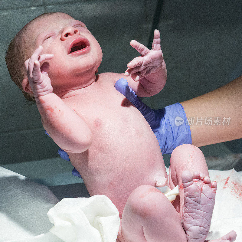 刚出生的婴儿，刚出生就被医院的医生检查