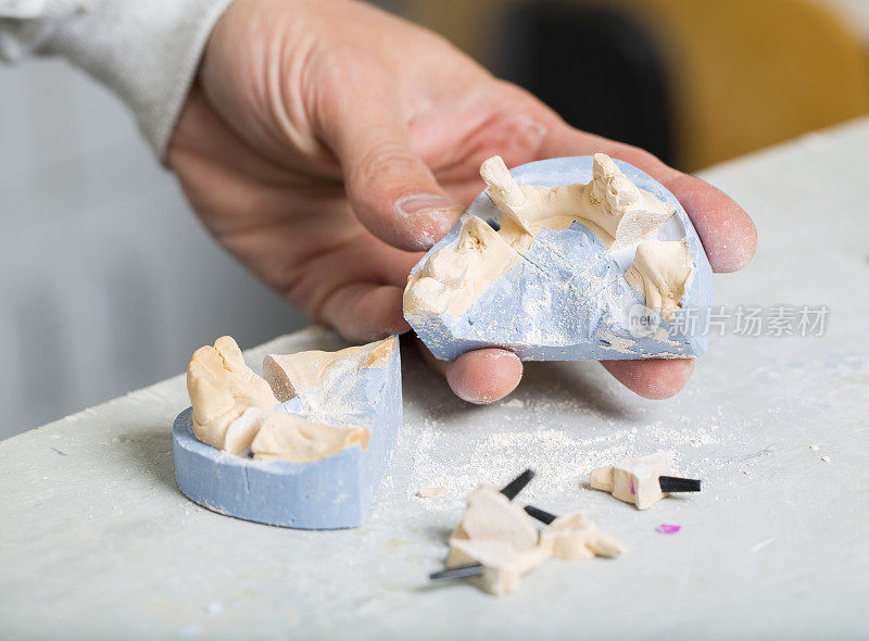 牙科修复的制造…牙科技术员在做假牙