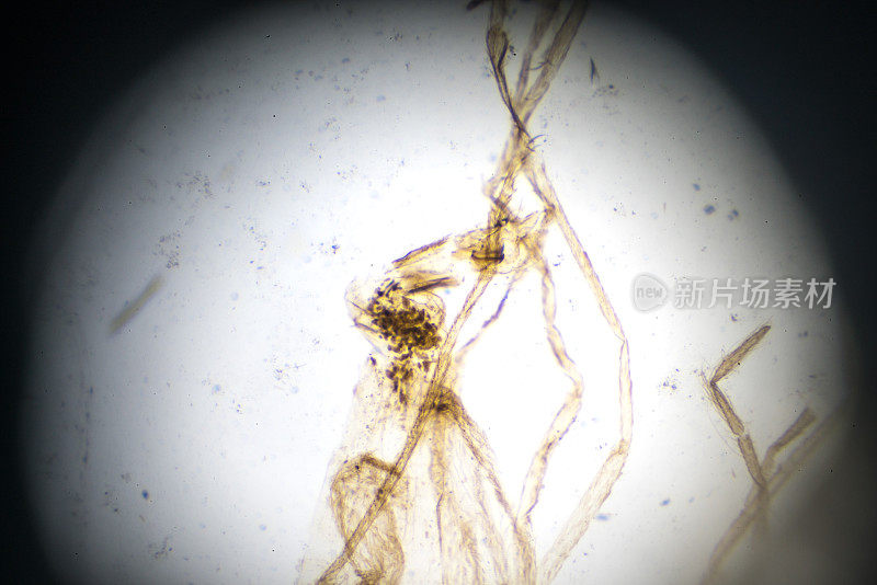 Mosquito-Male在显微镜下