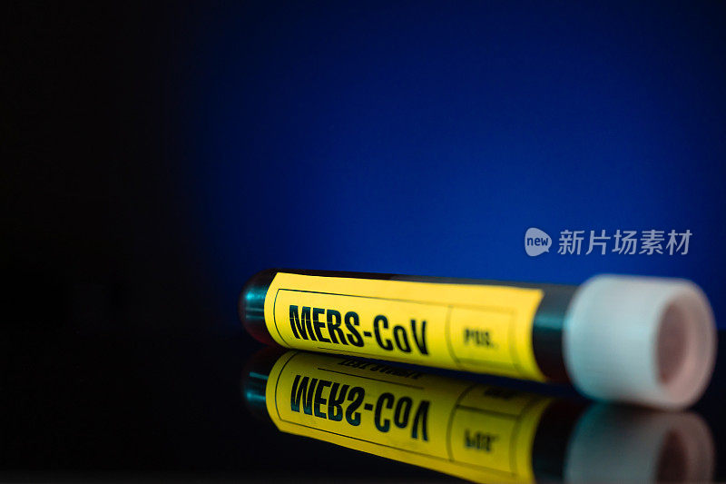 MERS-CoV病毒血样检测管特写黄色标记，蓝色背景