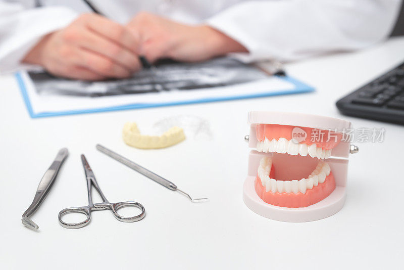 牙科诊所的牙齿模型。牙科保健