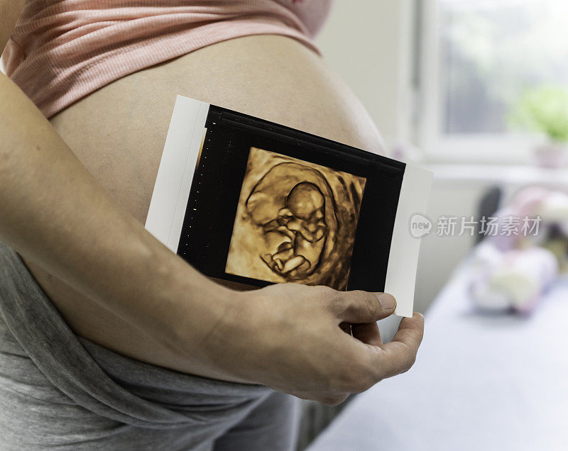 孕妇抱着超声波扫描的特写。怀孕保健概念。