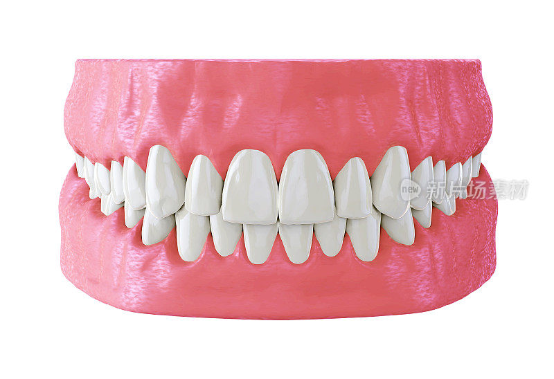 人类下巴与直白牙齿，正确的咬合，3d渲染