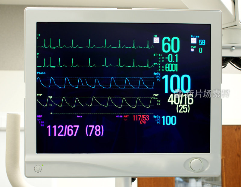 生命体征监测:心电图，脉氧仪，血压