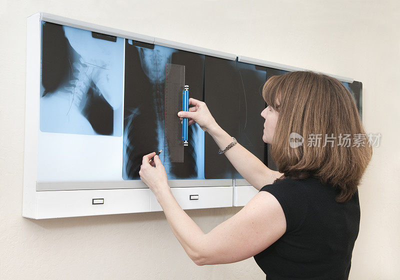 脊椎按摩师回顾病人的x光片进行治疗