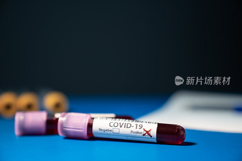 带有Covid-19病毒标记的血液试管