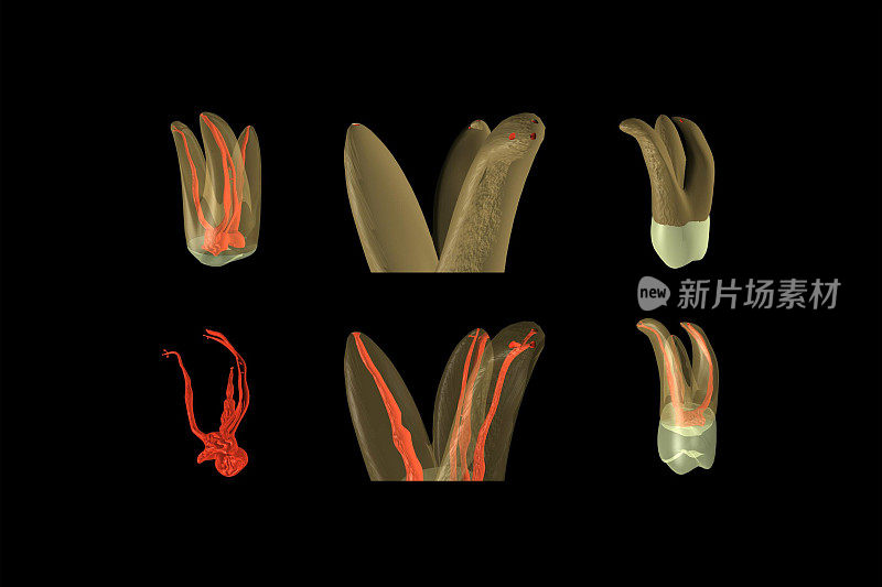 牙齿x射线