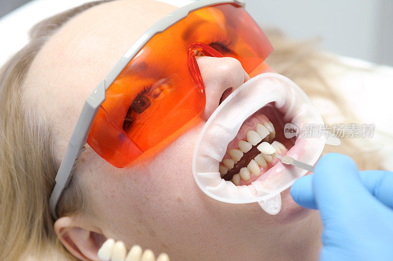经典牙齿着色法用于确定牙齿颜色旗牙美白、牙齿贴合用色度指导漂白剂配色、女性贴面微笑、口腔护理、牙科、影印空间。