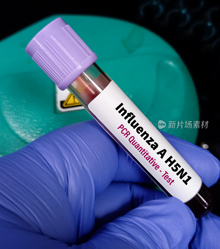 血液样本用于甲型流感H5N1聚合酶链式反应定量检测、禽流感病毒(AIV)、禽流感或禽流感。