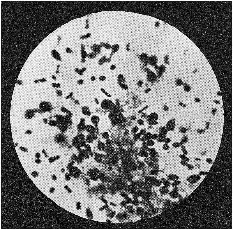 古董照片:葡萄牙鼠疫，芽孢杆菌