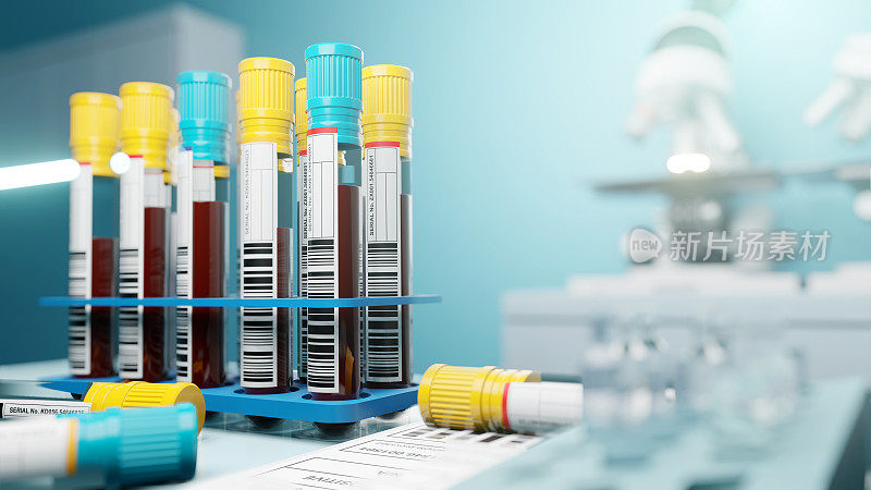 血液样本在实验室进行筛选